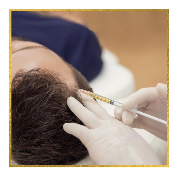 Injecting in scalp